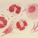 Neisseria gonorrhoeae