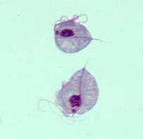 Trichomonas