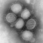Virus influenza tipo A H1N1, productor de la actual epidemia. Imagen de microscopía electrónica