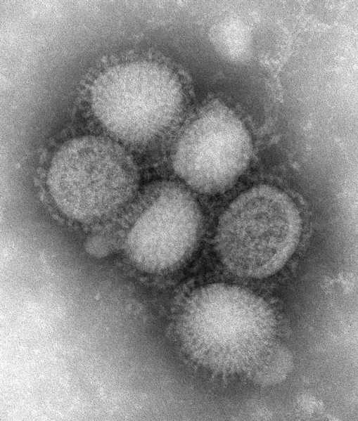 Virus influenza tipo A H1N1, productor de la actual epidemia. Imagen de microscopía electrónica