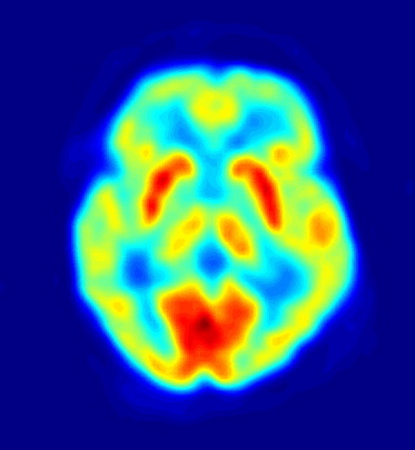 El colesterol es necesario para el desarrollo cerebral