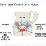 Incontinencia urinaria