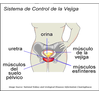 Incontinencia urinaria