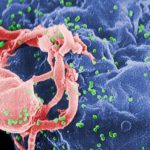 Hiv(en verde) sobre un linfocito. Microfotografia coloreada.