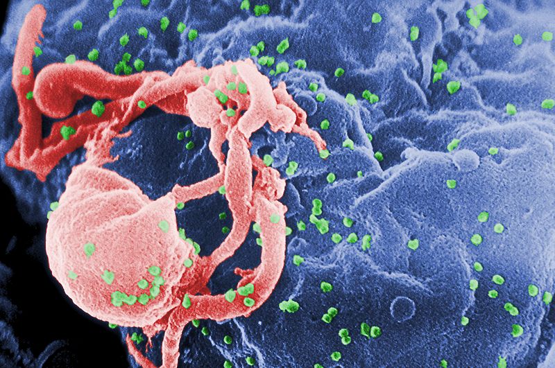 Hiv(en verde) sobre un linfocito. Microfotografia coloreada.