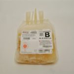Las transfusiones de plasma no se usan adecuadamente