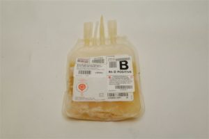 Las transfusiones de plasma no se usan adecuadamente