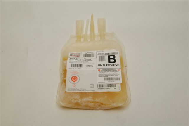 Las transfusiones de plasma no se usan adecuadamente