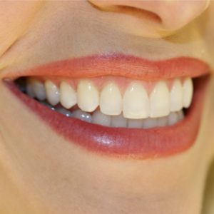 El 90% de las personas tiene caries y un 20-35% necesita prótesis.